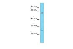 Sperm-associated antigen 7 Rabbit anti-Mouse, Polyclonal, Novus Biologicals:Antibodies:Primary